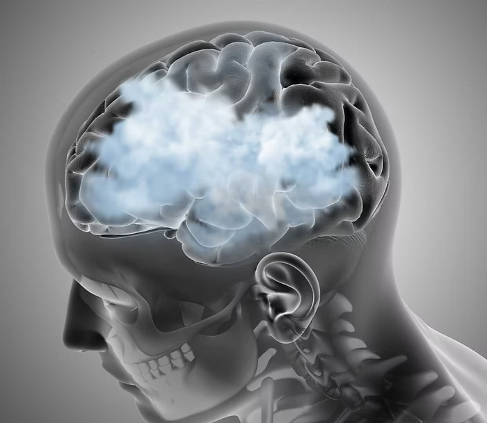 How-to-Reduce-Brain-Fog-with-Nootropics CONKA