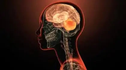 The-Link-Between-Brain-Fog-and-Inflammation CONKA